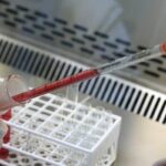 Bilim dünyasında bir ilk: Yeni kan grubu keşfedildi! Ne kan alabiliyor ne verebiliyor…