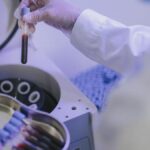 Prp Tedavisi Nedir, Nasıl Yapılır? Prp Tedavisi İşe Yarıyor Mu?
