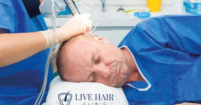 İstanbul Saç Ekimi ile Doğal ve Kalıcı Sonuçlar